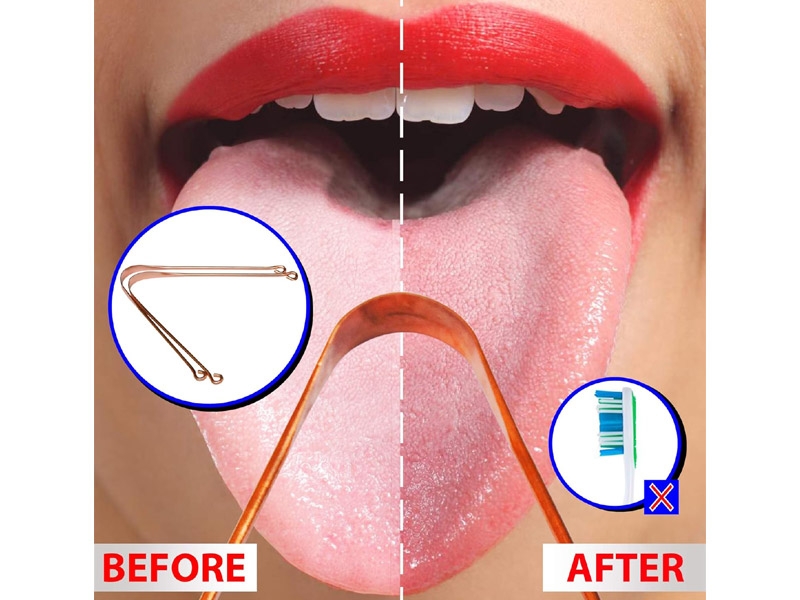 Pure Copper Tongue Cleaner Set of 12 for Bad Breath Treatment Naturally